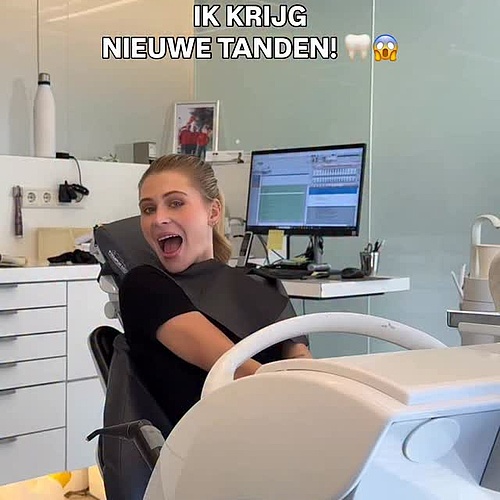 Van composiet facings op mijn 19e… naar eindelijk beginnen aan mijn droomsmile met No Prep Veneers 😭🦷 Ik neem jullie...